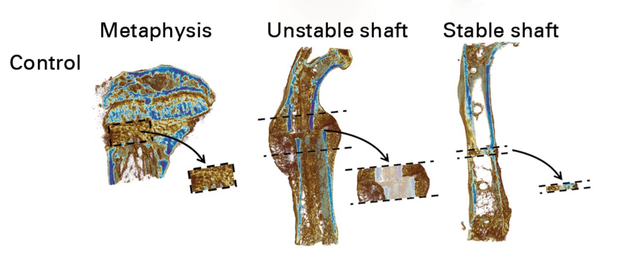 Figs. 2a - 2b 
            MicroCT scans with the volumes of
interest (VOI) extracted. In order to ensure that the images in
this figure are representative, the figure shows the specimen with
the median value for bone volume (BV), or bone area, from each treatment
group. Areas with decreased opacity in the unstable shaft VOIs indicate
areas that were excluded from calculations of BV and tissue mineral density.
          