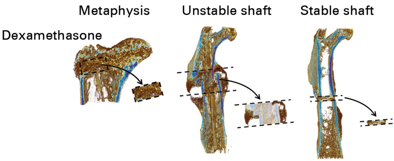 Figs. 2a - 2b 
            MicroCT scans with the volumes of
interest (VOI) extracted. In order to ensure that the images in
this figure are representative, the figure shows the specimen with
the median value for bone volume (BV), or bone area, from each treatment
group. Areas with decreased opacity in the unstable shaft VOIs indicate
areas that were excluded from calculations of BV and tissue mineral density.
          