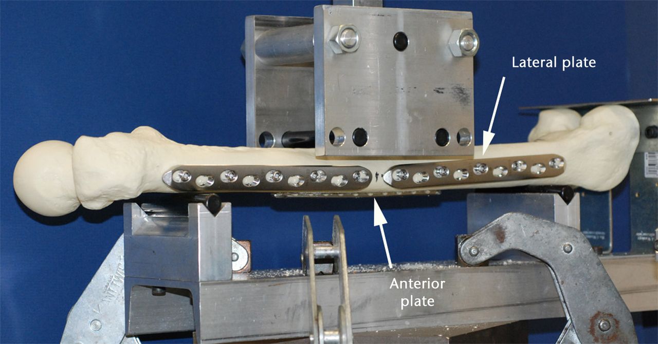 Fig. 2 
          Photograph showing the four-point bend
testing fixture that was used to load each femur in the sagittal
plane. Each femur was positioned in a four-point bend fixture such
that the loading occurred in the sagittal plane with tensile forces
seen on the anterior face of the femur.
        