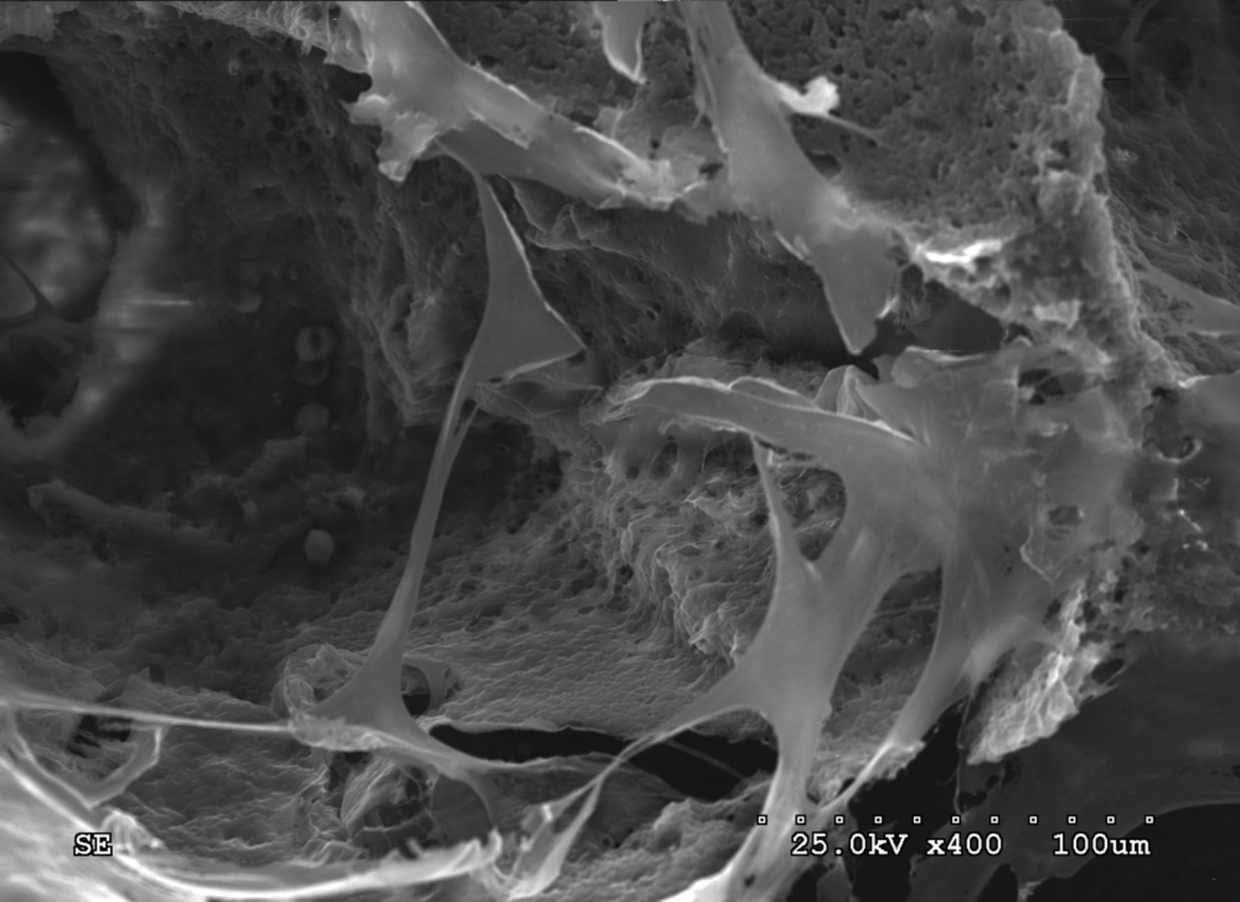 Fig. 4 
          Scanning electron microscope micrographs
showing canine bone marrow stromal stem cells adhering to the scaffold
(Scanning electron microscopy, × 400)
        