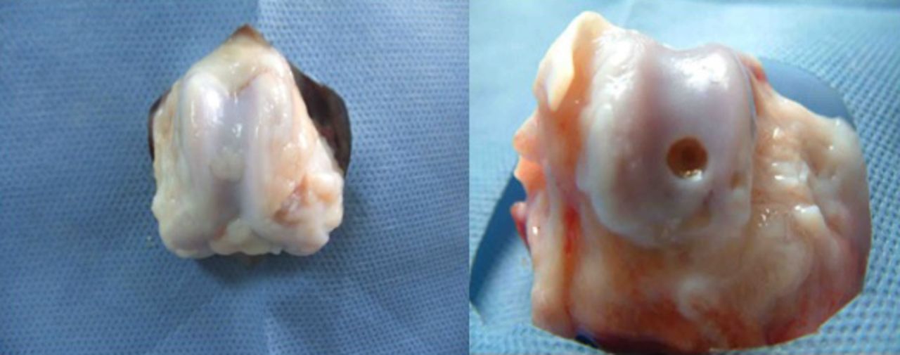 Fig. 6 
          Photographs of the surface of the cartilage
at 12 weeks post-operatively in the experimental group (control
group on the right). The regenerated tissues were slightly higher
than the surrounding cartilage, with a colour and lustre similar
to that of the surrounding normal tissue.
        