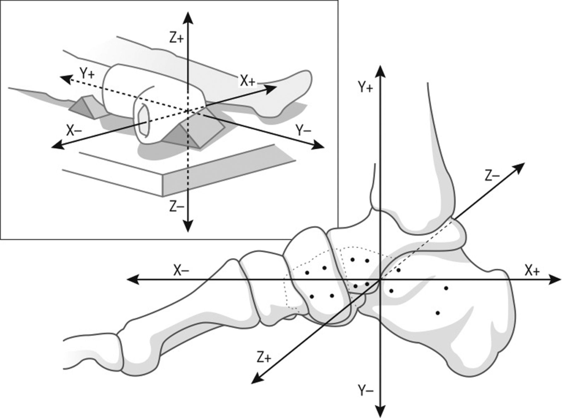 Fig. 2 
            Drawing illustrating the orientation
of the coordinate system relative to the anatomy of the foot. The
foot is viewed from the medial side, with the dotted lines representing
the contour of the distal part of both the calcaneal bone and the
cuboid bone. The drawing in the upper left corner illustrates the
positioning of the foot for future clinical studies.
          