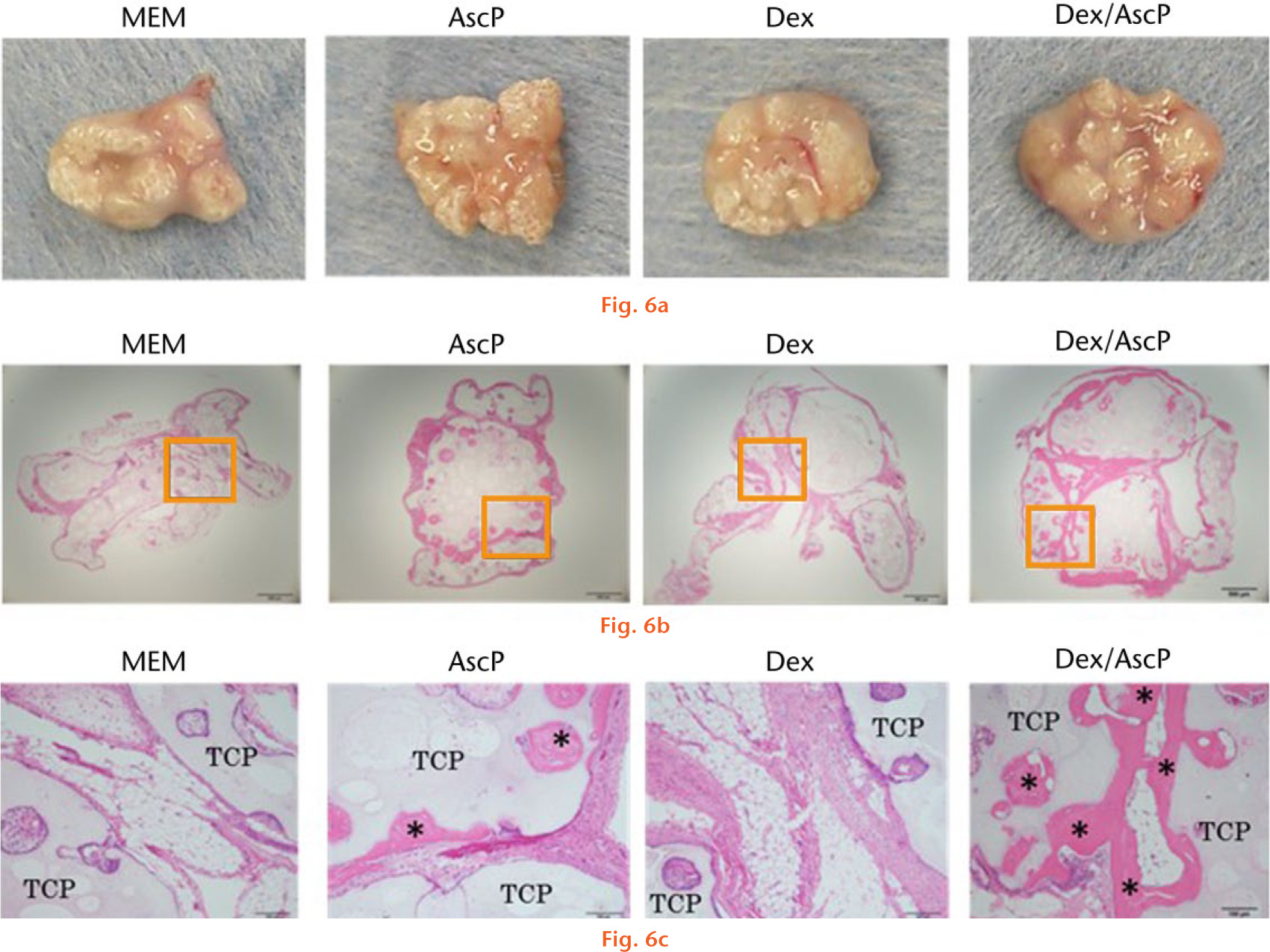  
          Representative images of the samples harvested four weeks after transplantation: a) macroscopic observation indicated that the transplanted β-tricalcium phosphate (TCP) scaffolds aggregated into a single lump in the dexamethasone (Dex)/ascorbic acid phosphate (AscP) group; b) and c) haematoxylin and eosin stained sections showed remarkable bridging bone formation between the β-TCP scaffolds in the Dex/AscP group. The panels in (c) are higher magnification views of the rectangular areas indicated in (b) (*bone tissue; bar, 200 μm).
        