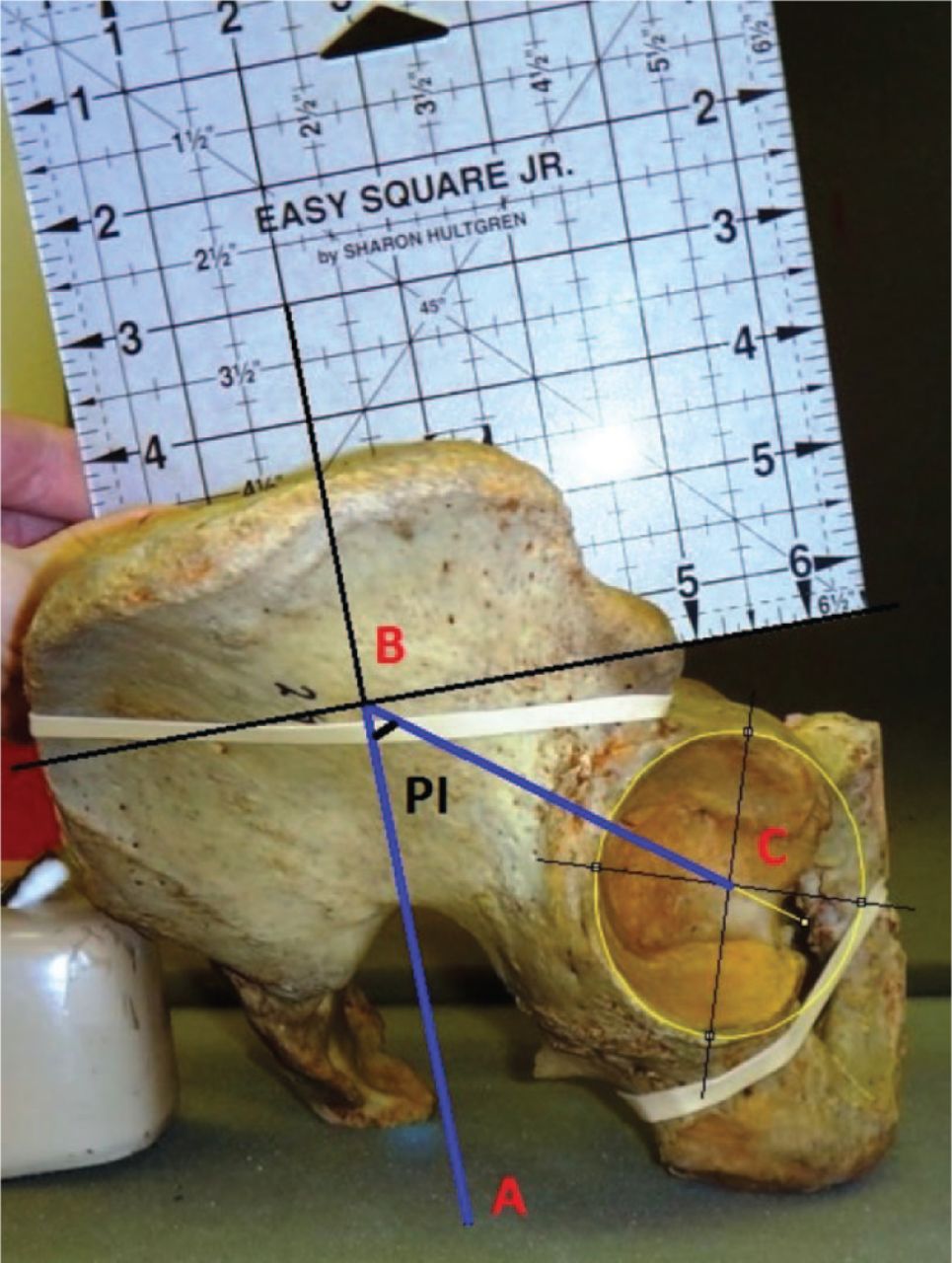 Fig. 3 
            Photograph showing a specimen of the measurement of pelvic incidence. Point B represents the centre of the sacral endplate. Point C represents the centre of the acetabulum measured from a direct lateral view of the pelvis. Angle ABC represents pelvic incidence.
          
