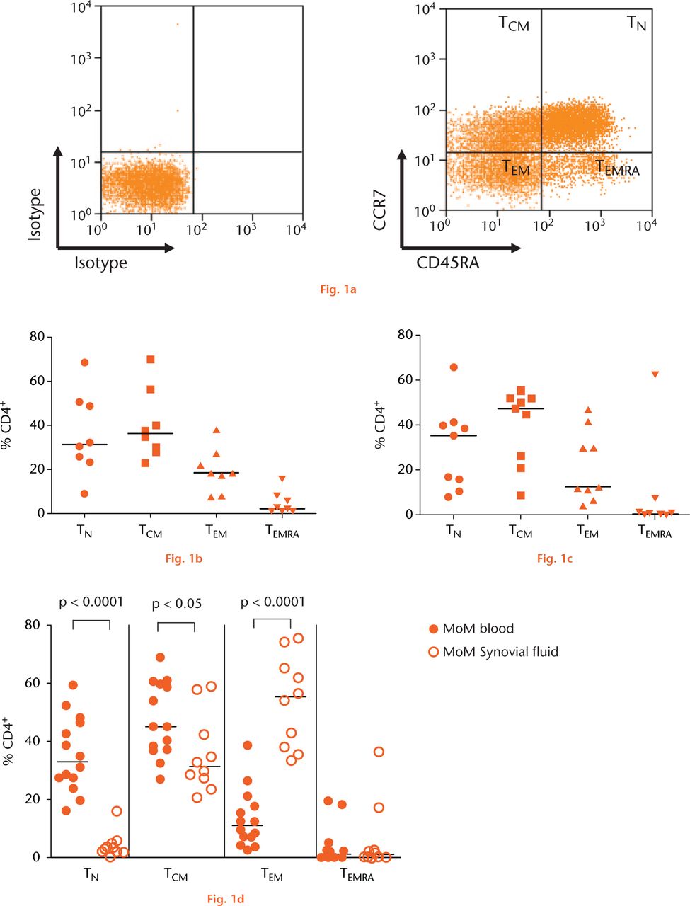  
            Graphs showing naïve and memory CD4+ T-cell subpopulations in two groups of revised hip arthroplasty patients and a control group with osteoarthritis: (a) Mononuclear cells gated for CD3+ and CD4+ were divided into naïve and memory subpopulations using CCR7 and CD45RA markers, (b) Pooled data for subpopulations of CD4+ T-cells in peripheral blood of the control group with osteoarthritis (OA) (n = 8). Horizontal lines indicate medians, (c) Pooled data for blood CD4+ T-cell subpopulations in patients with metal-on-polyethylene (MoP) hips (n = 9). Horizontal lines indicate medians,(d) Naïve and memory CD4+ T-cell populations in peripheral blood (n = 14) and synovial fluid (n = 10) of patients with metal-on-metal (MoM) hips (D). Horizontal lines indicate medians. (TCM =central memory T-cell; TEM=effector memory T-cell; TN=naïve T-cell; TEMRA=terminally differentiated effector memory cell).
          