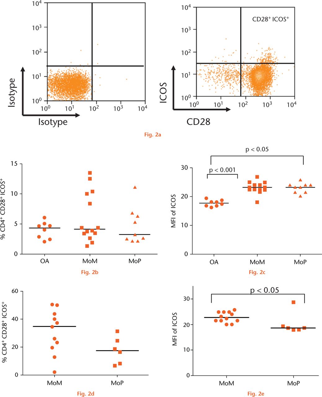  
            Graphs showing the expression of inducible co-stimulator (ICOS) on CD4+ T cells: (a) Expression of CD28 plotted against ICOS on CD3+ CD4+ T-cells. b) Pooled data of frequency of CD4+ CD28+ T-cells expressing ICOS in the peripheral blood of a control group with osteoarthritis (OA) (n = 8), metal-on-metal (MoM )hips (n = 14) and metal-on-polyethylene (MoP) hips (n = 9). Horizontal lines indicate medians. c) Median fluorescence intensity (MFI) of ICOS in the peripheral blood of a control group with osteoarthritis (OA) (n = 8), MoM hips (n = 14) and MoP hips (n = 9). Horizontal lines indicate medians. d) The frequency of CD4+CD28+ICOS+ T-cells in the synovial fluid of patients with MoM (n = 11) and MoP hips (n = 6). Horizontal lines indicate medians. e) MFI of ICOS on CD4+CD28+ T-cells in the synovial fluid of patients with MoM (n = 11) and MoP hips (n = 6). Horizontal lines indicate medians.
          