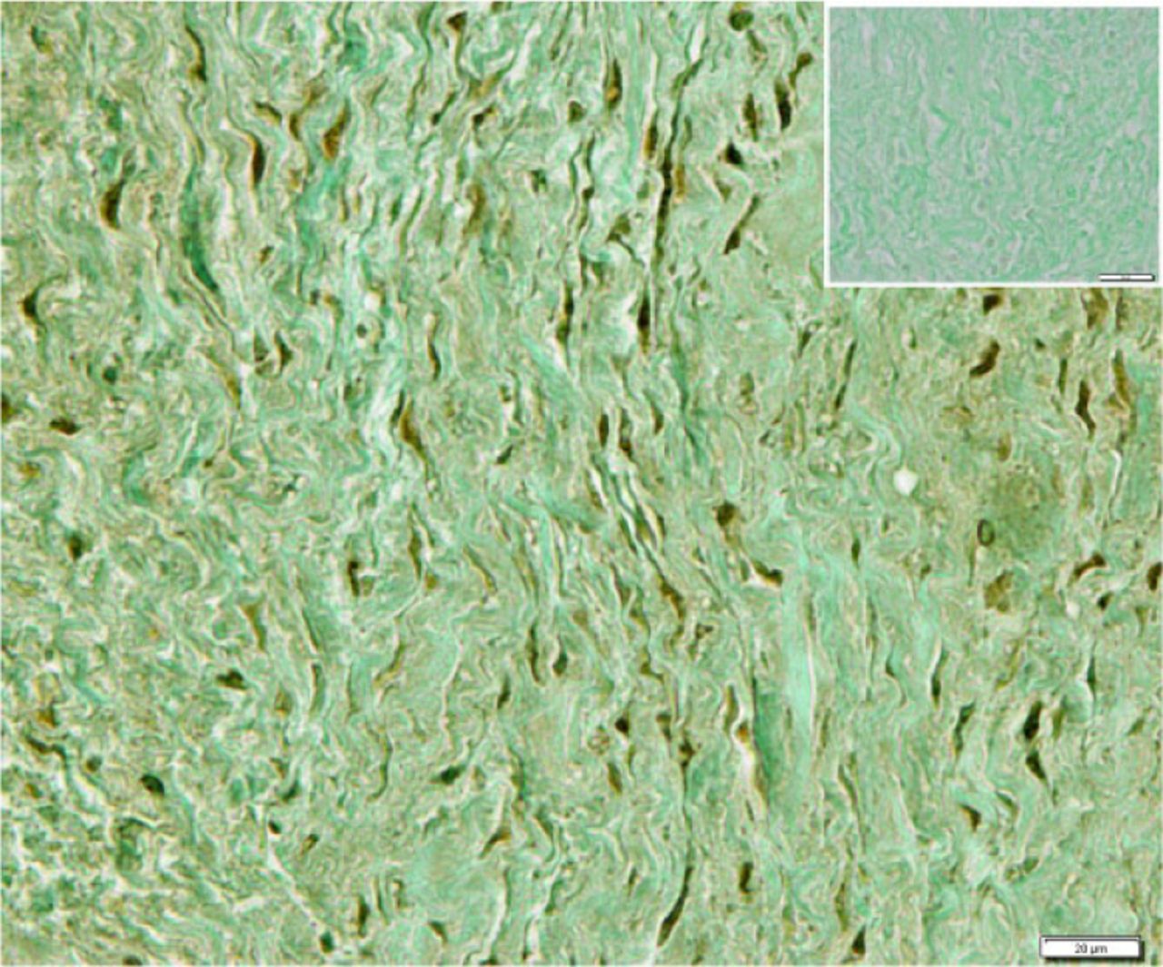Fig. 4 
            Immunohistochemical localisation of runt-related transcription factor 2 within the biomembrane. Insert upper right shows an adjacent section processed as a negative control (Bar = 20 µm).
          
