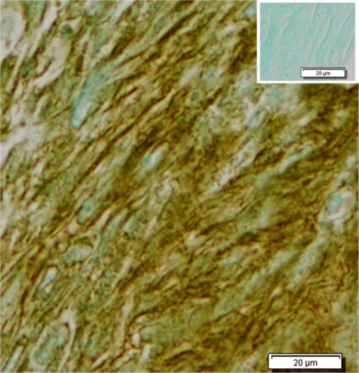 Fig. 7 
            Micromass specimen embedded in paraffin and processed for immunohistochemical localisation of chondroitin sulfate. Note the abundant presence of this matrix component. Insert upper right shows an adjacent section processed as a negative control (Bar = 20 µm).
          