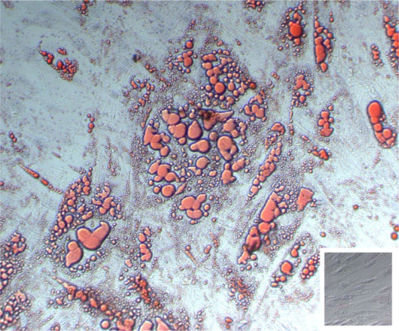 Fig. 8 
            Biomembrane cells cultured for adipogenesis show the presence of fat droplets (stained red in the micrograph). Insert lower right shows that biomembrane cells cultured in control media showed no presence of fat droplets (original magnification ×200).
          