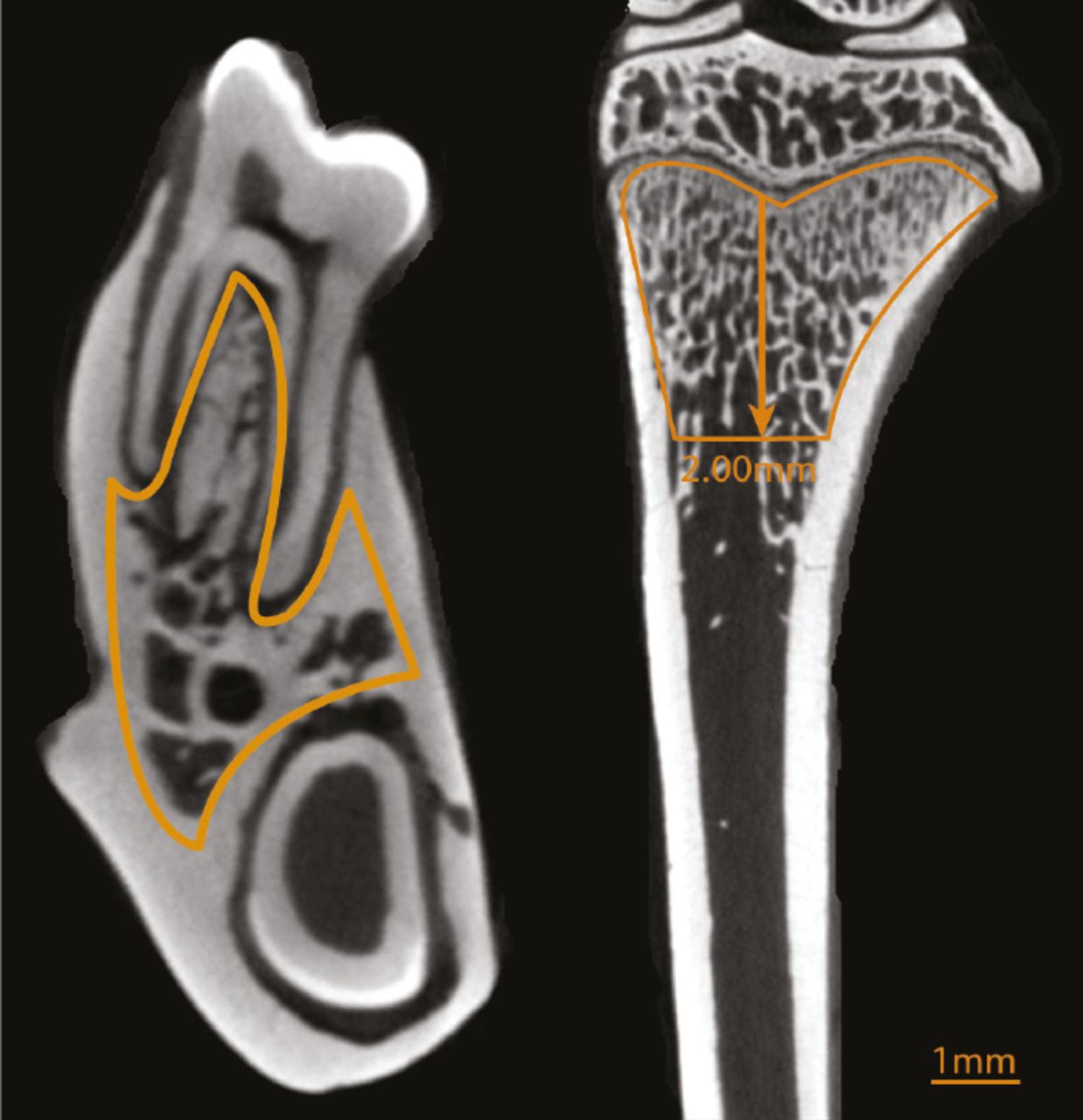 Fig. 1 
            This representative image from a micro-CT shows that the region of interest (ROI) on the mandible in the axial plane and on the tibia in the coronal plane (the yellow outline represents the ROI on mandible and tibia). Scale bar = 1 mm.
          