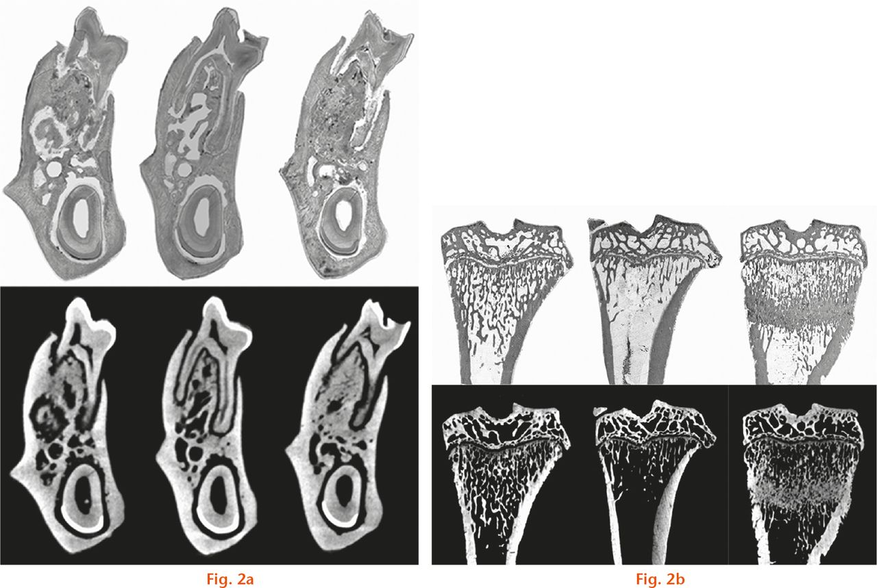  
            These images show the bone micro-architecture of the a) mandible and b) tibia among sham, ovariectomised (OVX) and zoledronate-injected ovariectomised (OVX-ZOL) groups in the coronal plane. The first row represents a single histological section. The second row represents a 3D reconstruction corresponding to histological section. Scale bar = 1 mm.
          