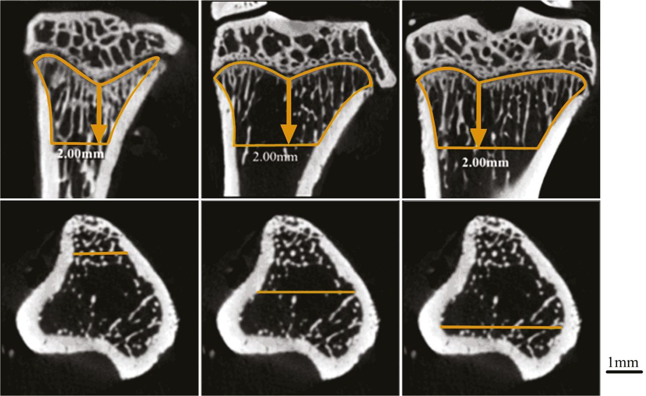 Fig. 8 
          Visual comparison of numbers of trabeculae between the central and peripheral cancellous bone of tibia in ovariectomised rats in coronal planes. The first row represents the trabeculae of coronal planes derived from different locations of cancellous bone in tibia (represents the front, middle, or back plane). The second row shows the transverse plane of tibia where the yellow lines mark the corresponding coronal locations in the first row for observation of cancellous structures. Scale bar = 1 mm.
        