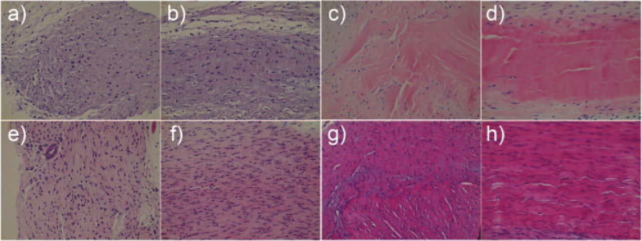Fig. 4 
            Histological images of the regenerated tissue: a) and b) control side at post-operative week 4; c) and d) inducing graft (IG) side at post-operative week 4; e) and f) control side at post-operative week 8; g) and h) IG side at post-operative week 8; a), c), e), and g) are transverse sections, b), d), f), and h) are longitudinal sections. The magnification is ×400.
          