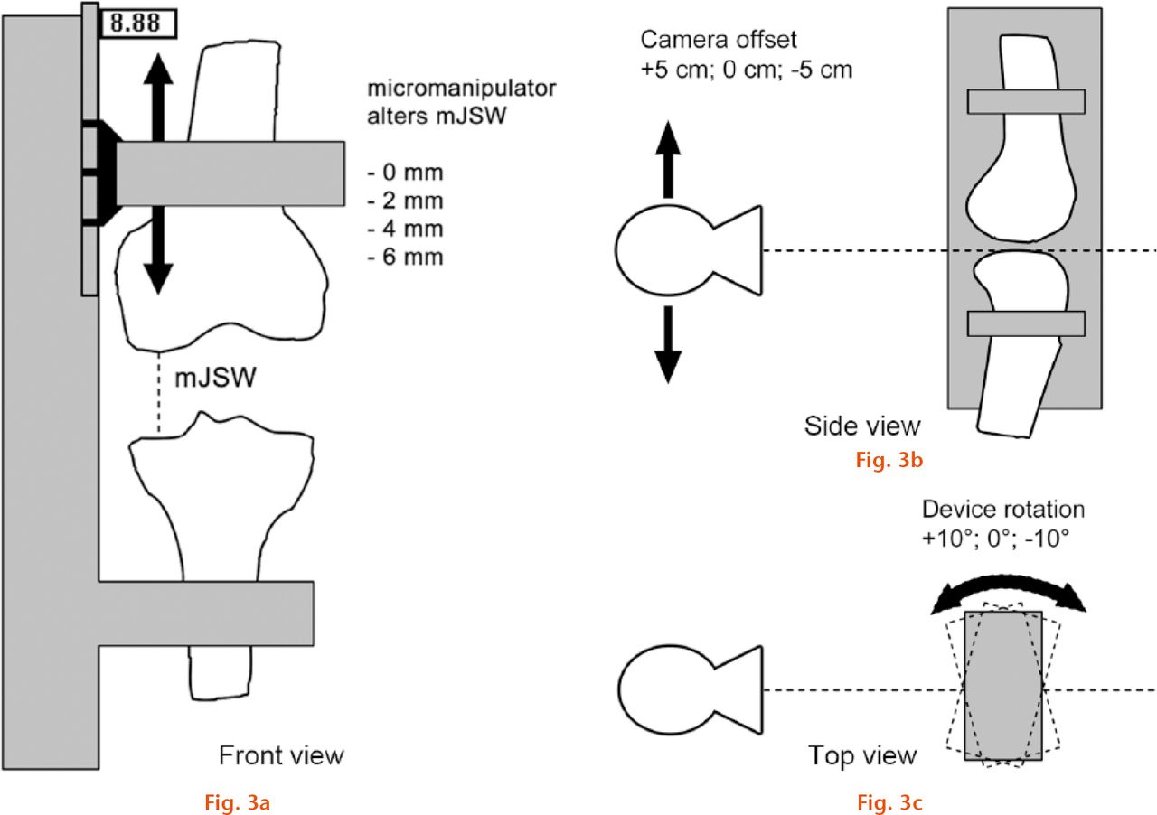  
            a) Schematic view of the positioning device and manipulation of the actual mJSW; b) effect of manipulating the X-ray tube offset parameter; c) effect of manipulating the internal rotation of the positioning device.
          