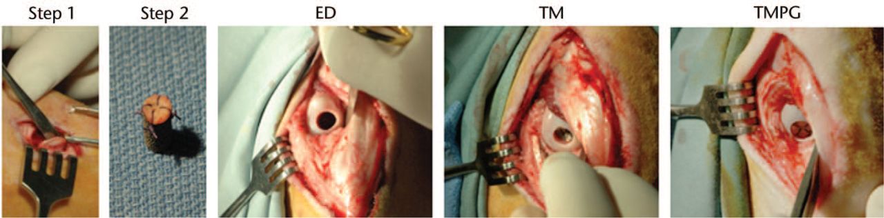 Fig. 1 
            Surgical procedure of different treatments. Step 1, periosteal graft elevation from the medial aspect of the tibial head. Step 2, periosteal graft sutured to trabecular metal cylinder with cambium facing away from the metal implant. Large pictures show defects that were left untreated (ED) or after implantation of trabecular metal (TM) or trabecular metal in combination with a periosteal graft (TMPG).
          