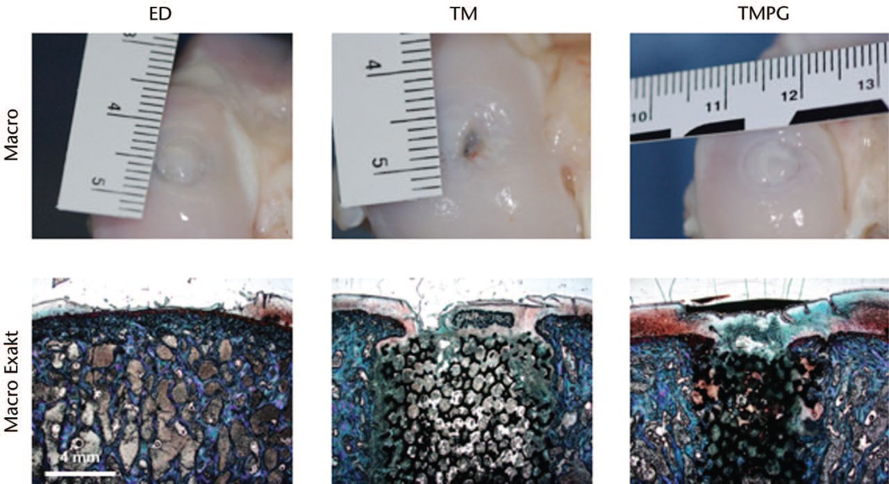 Fig. 2 
            Upper row shows the macroscopic appearance of the best regenerate found after different treatments. Notice the metal implant shining through the glistening white neo-cartilage both in the trabecular metal (TM) and trabecular metal in combination with a periosteal graft (TMPG) sections. Bottom row shows best histological results of the different treatments (Exakt system, Safranin-O/ Fast Green). Microscopic pictures do not necessarily correspond to macroscopic sections. ED untreated
          