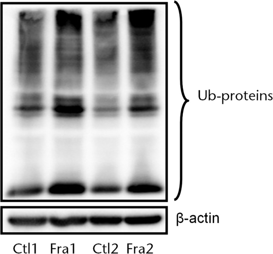 Fig. 3 
            Increased total ubiquitinated proteins in fracture callus. WT mice received bone fracture surgery as in Figure 1. Callus tissue from fractured legs was harvested at day 7 after mice received MG132 for 24 hours. Total ubiquitinated (Ub) proteins were determined by Western blot analysis using anti-ubiquitin antibody. The cortical bone samples from the non-fractured legs were used as a control (Ctl).
          