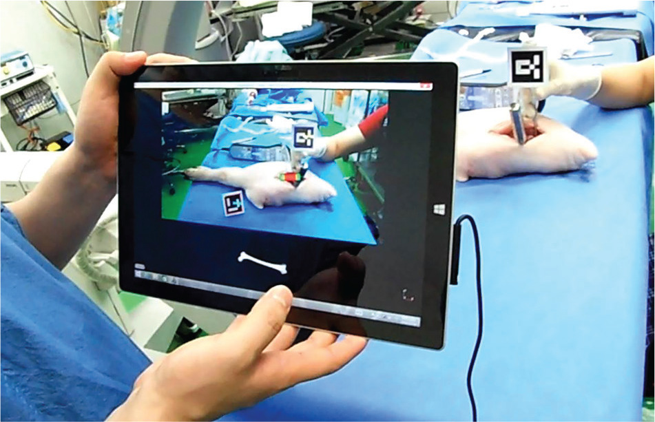 Fig. 4 
            Determination of osteotomy site using augmented reality based navigation guidance.
          