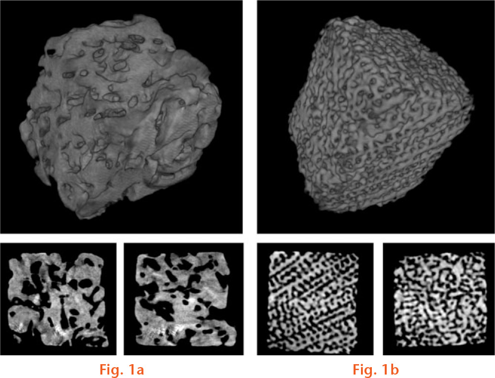  
            Display of a) Acropora and b) Porites scaffolds accessed by microCT: Acropora exhibited larger and more irregular pore size; Porites had a more homogeneous structure with smaller pores. The porosity of Acropora was lower than that of Porites.
          