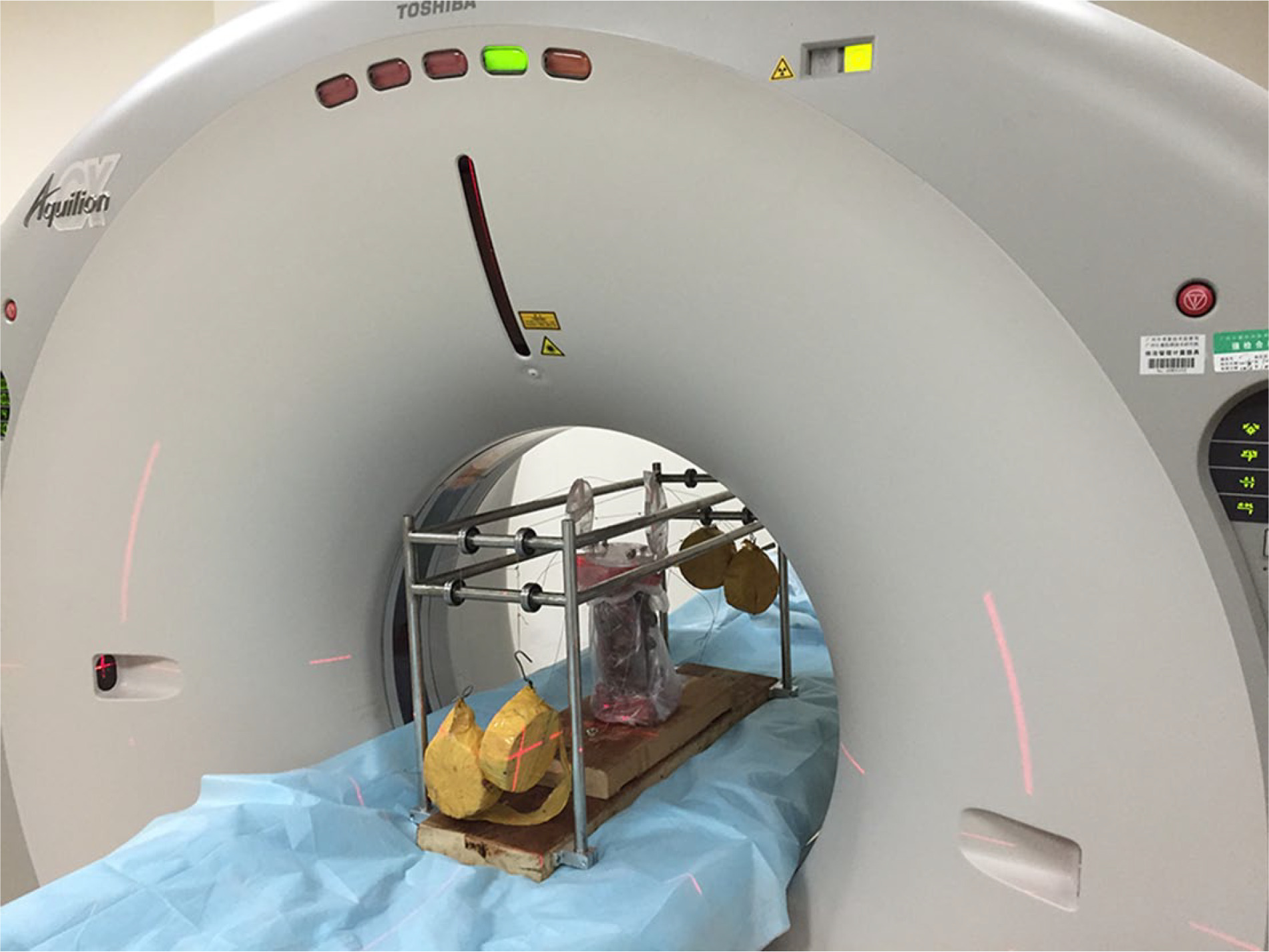 Fig. 1 
            An experimental set-up of CT scanning of the lumbar specimen by using the equipment with a 6 Nm pure moment.
          
