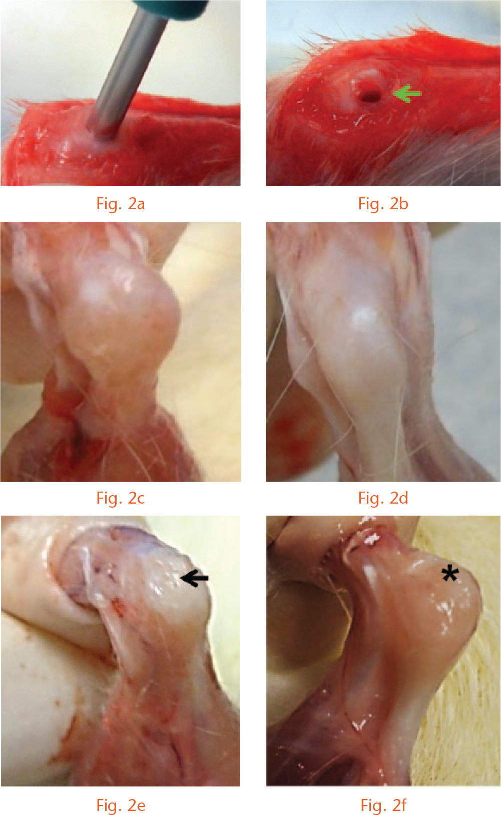  
            Images showing the gross examination of the effect of kartogenin platelet-rich plasma (KGN-PRP) on the healing of wounded rat Achilles tendon entheses (ATEs). a) A 1 mm diameter wound was made in the rat ATE (3 mm total width) using a biopsy punch. b) Wound in the rat ATE. c) Wounded rat ATE 3 months after KGN-PRP treatment. d) An intact rat ATE. e) Wounded rat ATE after PRP treatment shows a wound healing site with uneven surface (arrow). f) Wounded rat ATE after saline treatment also shows incomplete healing with a rough surface and smaller healed region and reddish immature tissues (*).
          