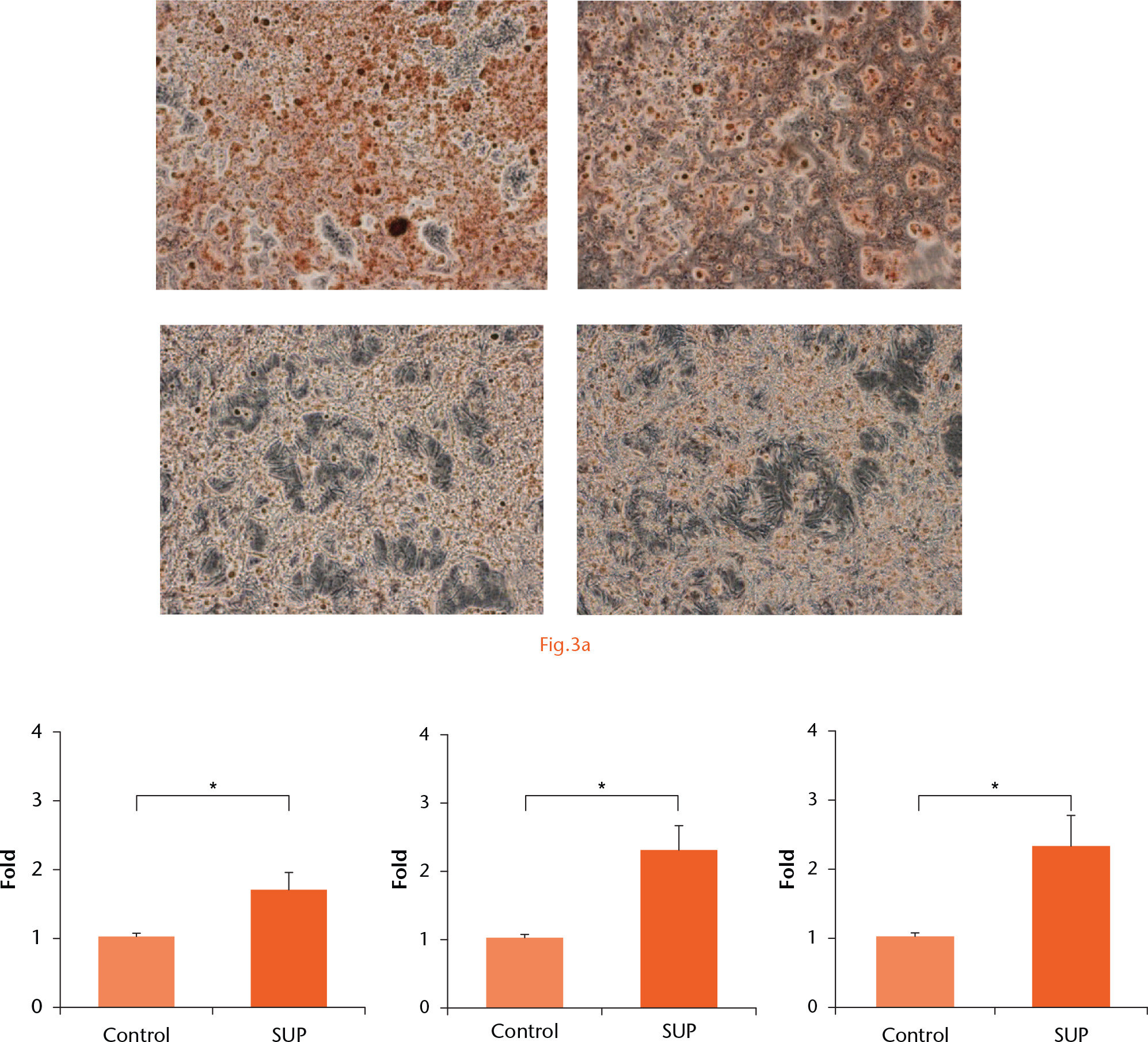 
          Osteogenic differentiation capacity: a) Photomicrographs showing alizarin red staining at 14 days after addition of skeletal muscle supernatant. Control cultures were treated with PBS: top row: supernatant group; bottom row: control group; b) expression levels of RUNX2 (left), COL1a1 (middle) and osteocalcin (right) at 14 days after addition of skeletal muscle supernatant, analysed by real-time PCR (n = 6) (*; p < 0.05).
        