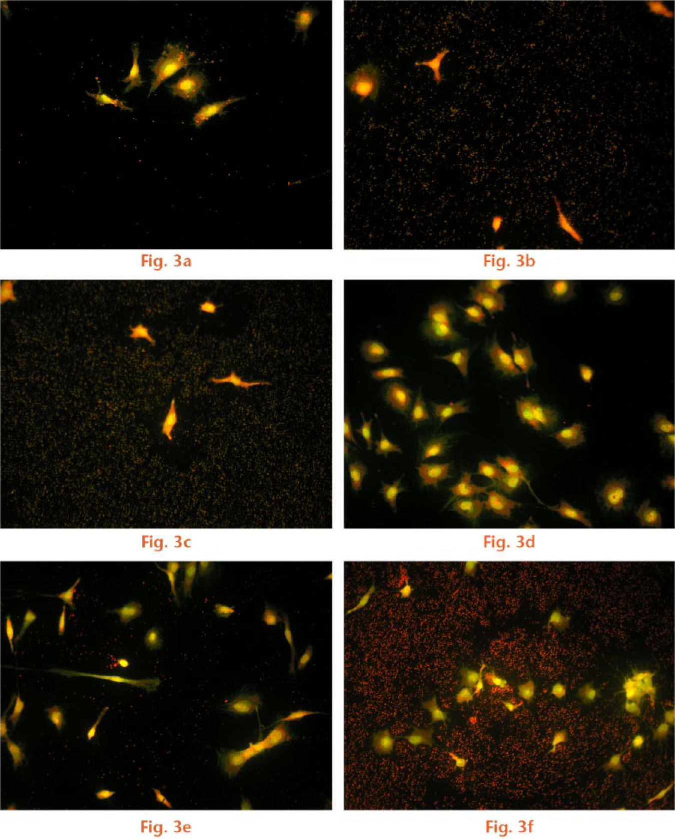  
            Representative fluorescence microscope images of adherence of clinical strains in the presence of pre-osteoblasts. 3A-C: S. aureus strain P2 (concentrations: A-104, B-106, C-108). 3D-F: S. epidermidis strain P55 (concentrations: D-104, E-106, F-108). 200x magnification.
          