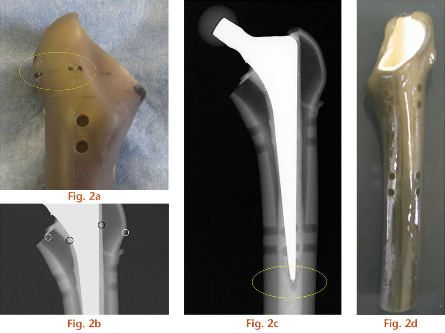  
            a) Figure showing small drilled holes for inserting tantalum balls; b) radiograph film after fixing stem with cement. Tantalum markers are visible on the outside of the composite femur (white circles) and in the cement (black circles); c) Radiograph showing placement of tantalum balls near the tips of the stems and d) Figure showing a ball-composite femur unit soaked in vegetable oil.
          