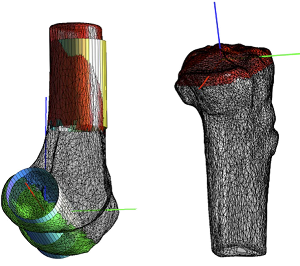 Fig. 1 
            CT bone model of the femur to the left, and the tibia to the right, with their local coordinate systems (red = laterally, green = anteriorly and blue = proximally). Colored areas and cylinders were used for placing the coordinate systems. The colored bone areas were used to fit the cylinders and the medial-lateral axis (red axis) and the proximal-distal axis (blue axis) was determined from the cylinders.
          