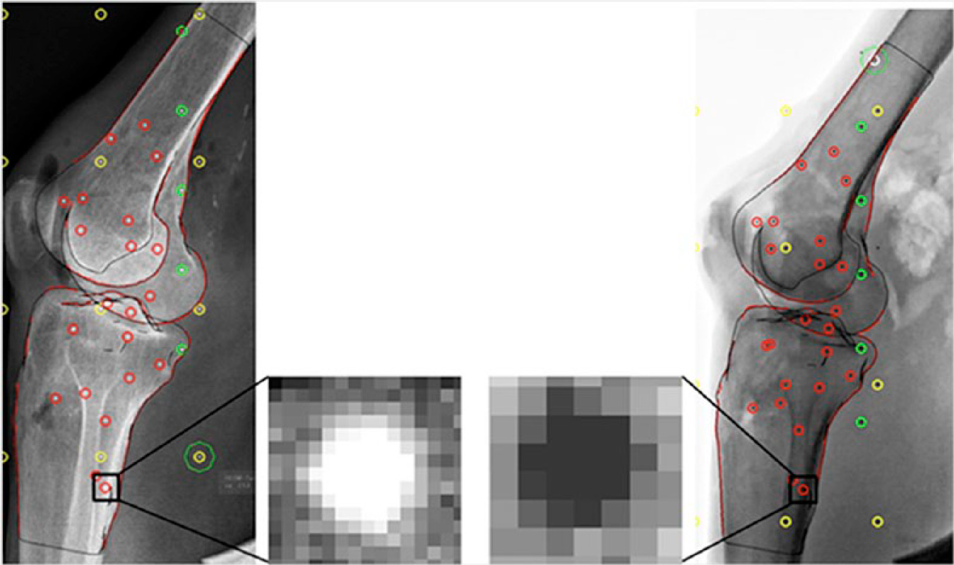 Fig. 3 
            Left: static radiographic image. Right: dynamic radiographic image. The magnified images show the resolution in the static image being twice that of the dynamic image. The yellow and green circles indicate the fiducial and control markers in the calibration box. The dynamic radiograph is inverted compared with the static radiograph and is a standard setting of the radiostereometric analysis system, which was not changed prior to the recordings, however, this difference poses no issues in analysis of the radiographs.
          