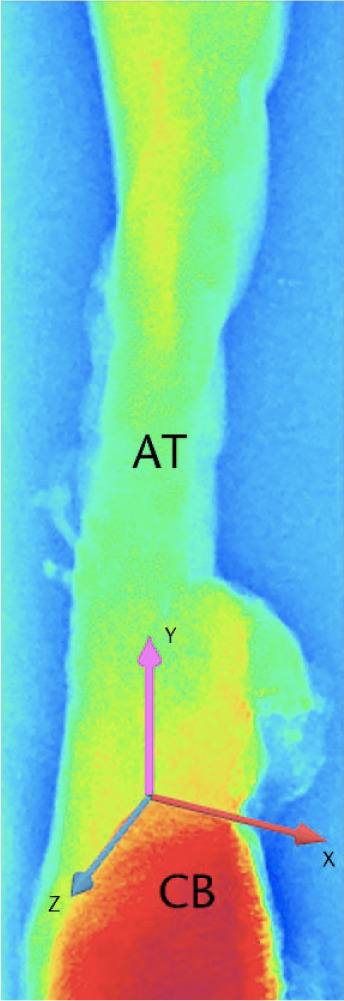 Fig. 1 
            Radiograph of an Achilles tendon specimen before contrast injection (CB, calcaneus; AT, Achilles tendon; x arrow, anterior direction; y arrow, superior direction; z arrow, depth).
          