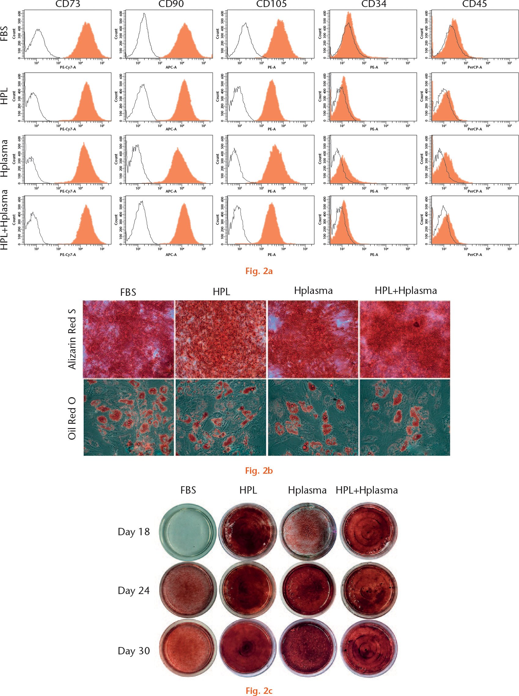  
            Characterisation of Adipose-derived mesenchymal stem cells (ADMSCs) after long-term culture in different supplements: a) immunophenotype of ADMSCs was determined by flow cytometry; b) osteogenic and adipogenic differentiation of ADMSCs was assessed by Alizarin Red S and Oil Red O staining, respectively; c) macroscopic examination of osteogenic differentiation which was assessed by Alizarin Red S staining at days 18, 24, and 30 (FBS, fetal bovine serum; HPL, human platelet lysate; Hplasma, human plasma).
          