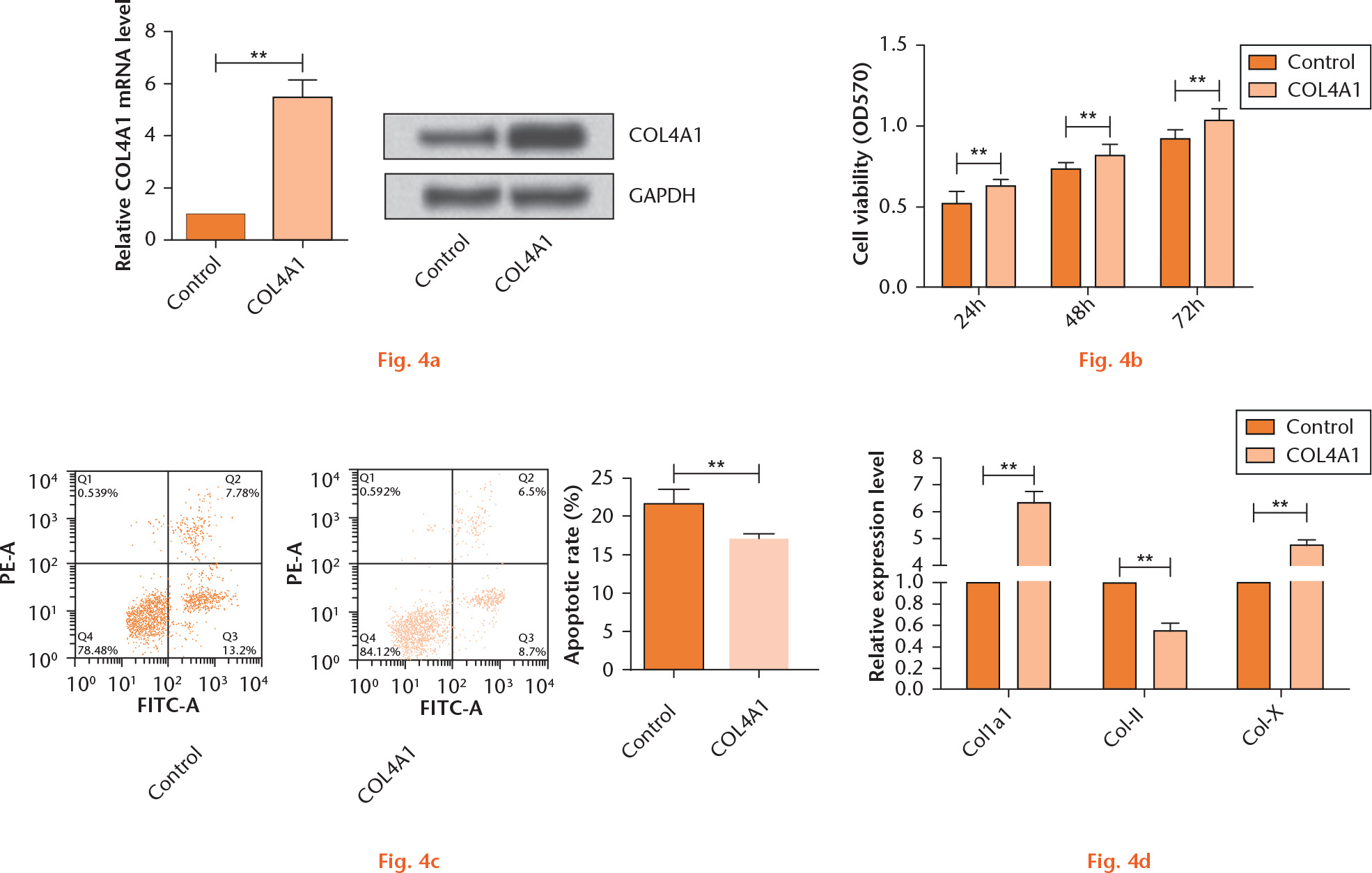  
            Overexpression of COL4A1 promotes cell viability, suppresses apoptosis, and changes collagen (COL) levels. a) Relative expression of COL4A1 after transfection with pcDNA3.1 (+)-COL4A1; b) effects of overexpression of COL4A1 on cell viability; c) effects of overexpression of COL4A1 on cell apoptosis; d) effects of overexpression of COL4A1 on the expression of COL1A1, COL-II, and COL-X. *p < 0.05, **p < 0.01 compared with the control group.
          