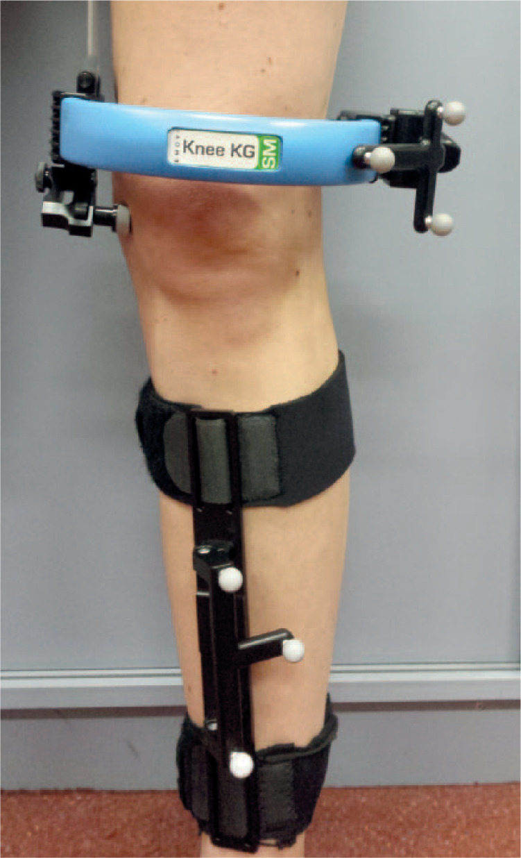 Fig. 1 
            Photograph showing tibial and femoral trackers positioned for left knee.
          