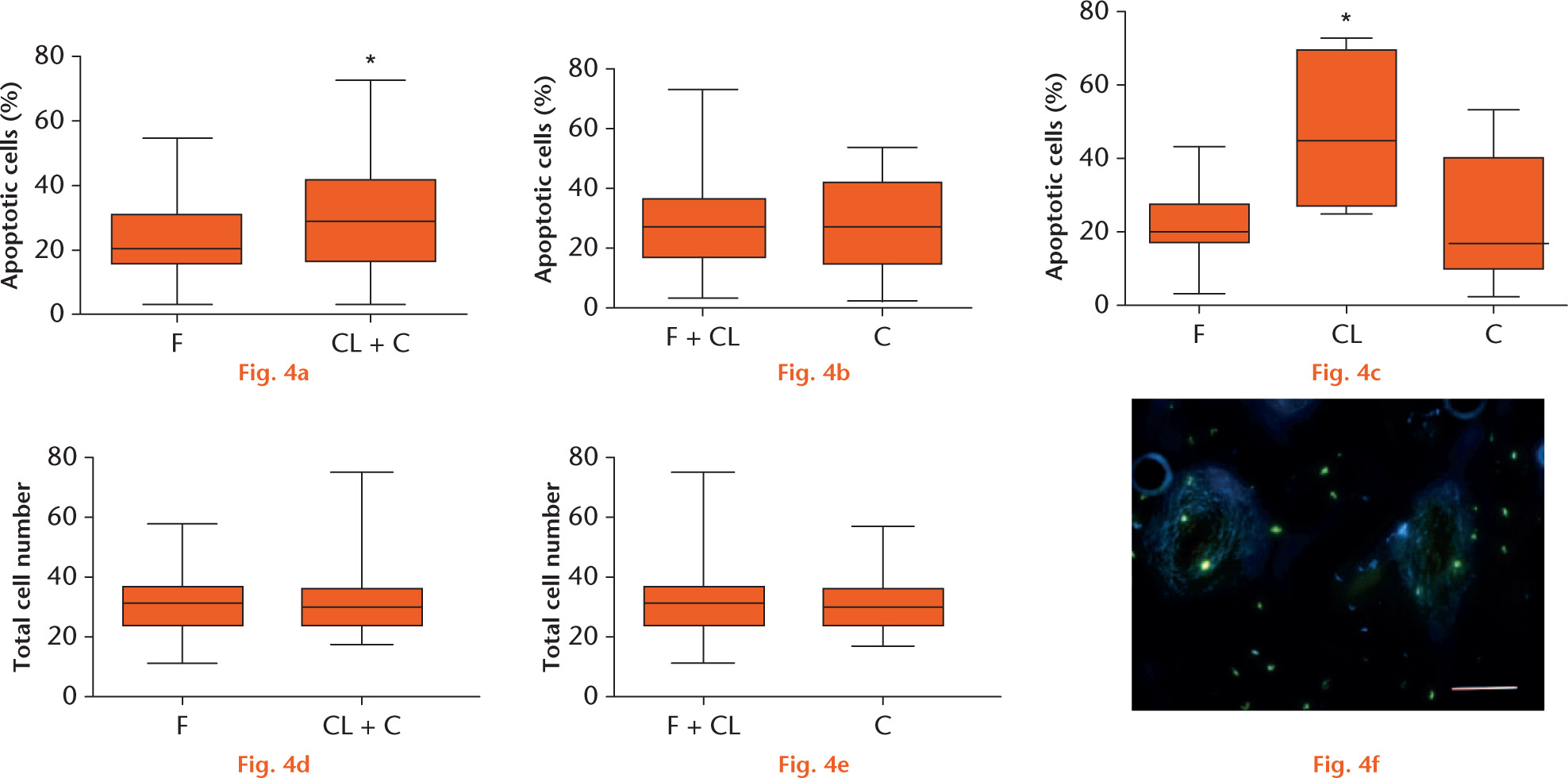  
            Graphs showing: a) quantification of apoptosis within osteocytes in nonfractured and fractured samples; b) raced and non-raced samples; and c) samples from the sagittal ridge. There is a statistically significant difference in the numbers of apoptotic cells (p < 0.05) between fractured and nonfractured samples (a) and in the numbers of apoptotic cells on the sagittal ridge, with a significant increase in apoptotic cells in the contralateral limb samples (c). No difference was recorded in the numbers of osteocytes in the samples d) and e). f) Representative microscope image of a fluorometric TUNEL apoptosis analysis. Blue stain shows live cell nuclei, green stain shows apoptotic cells. Scale bar 100 μm. F, fractured bones; CL, contralateral bones, C, control bones.
          