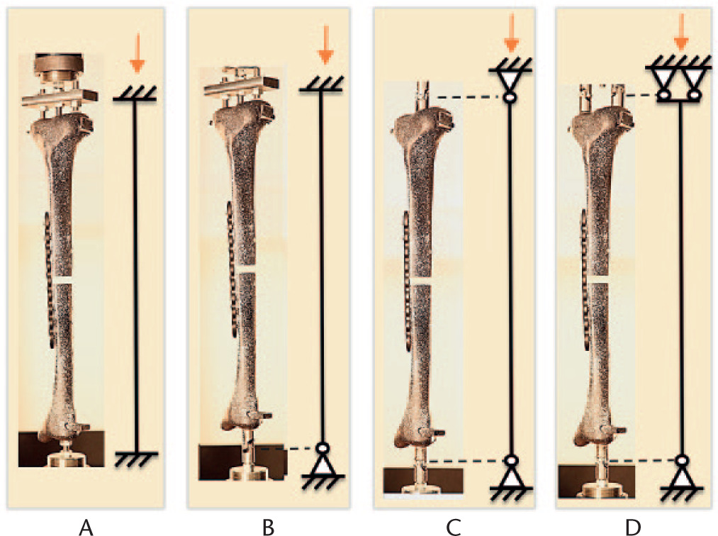 Fig. 1 
            Photographs of the four loading conditions tested and the corresponding engineering symbols: loading condition A, with clamped ends proximally and distally; loading condition B, with clamped end proximally and pinned end distally; loading condition C, with pinned ends proximally and distally; and loading condition D, with a hinge proximally and a pin distally. The speckled pattern on the surface of the composite tibia was used for digital image correlation.
          