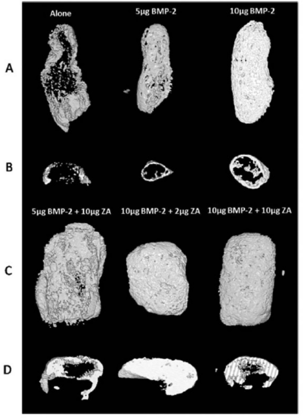 Fig. 5 
          3D rendering of the explants using micro-CT. The representative micro-CT constructs (a and b) and (c and d) show micro-CT slices (50 stack slices) of bone nodules formed from collagen-hydroxyapatite scaffolds loaded with saline, BMP-2 or BMP-2 + ZA at different concentrations. Reproduced from Murphy CM, Schindeler A, Gleeson JP, et al. A collagen-hydroxyapatite scaffold allows for binding and co-delivery of recombinant bone morphogenetic proteins and bisphosphonates. Acta Biomater 2014;10:2250–2258 (with permission from Elsevier).
        
