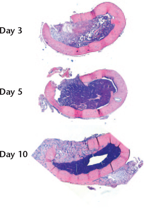 Fig. 7 
            Coronal sections of the femur. A longitudinal defect was created (upwards in the images). There was increasing cellularity of the bone marrow from days 3 to day 5. Immature bone filled the cortical gap by day 10, with a sharp demarcation from the regenerating marrow. Magnification 16×, haematoxylin and eosin.
          