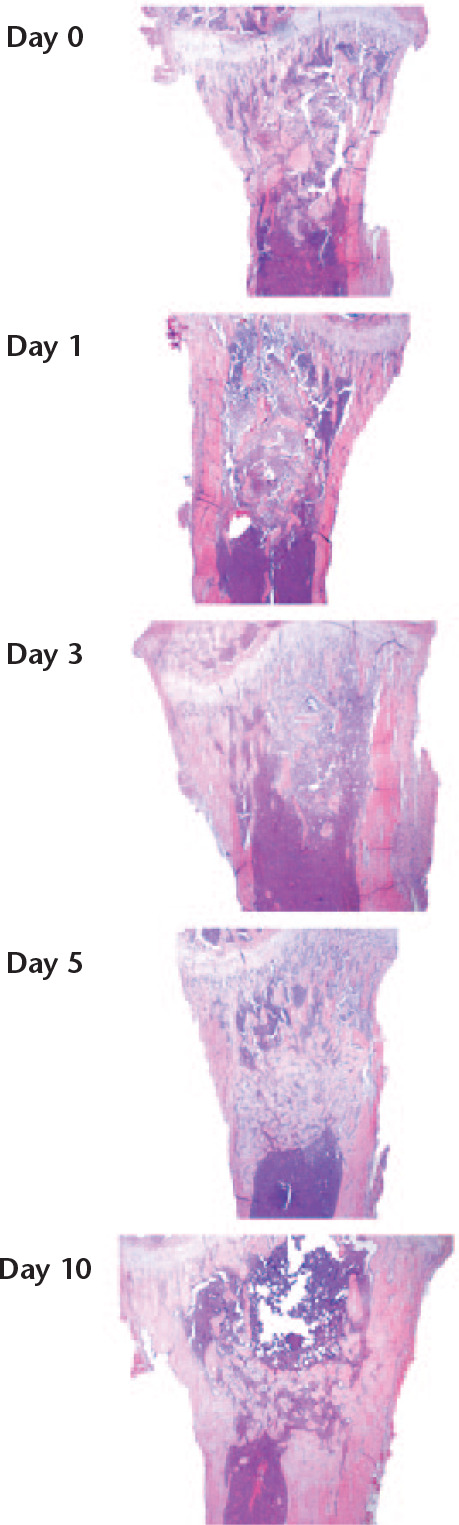 Fig. 8 
            The proximal tibia, traumatized with the nook of a needle. Frontal sections. Day 0 represents immediately following trauma. The traumatized area is approximately centred in all pictures. At days 0 and 1, a haematoma can be seen extending well beyond the zone of the initial trauma. At day 5, the traumatized region is filled with woven bone. At day 10, there has been some remodelling. Magnification 4×, haematoxylin and eosin.
          
