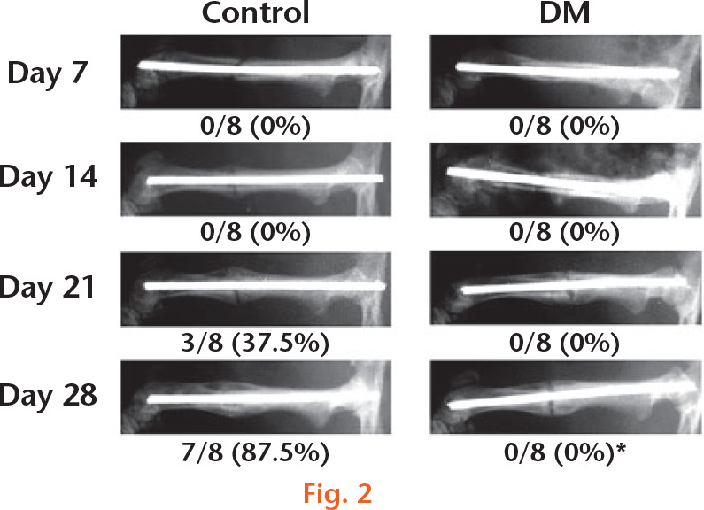 Fig. 2 
            Radiographs of femurs during fracture healing in the control and diabetes mellitus (DM) groups. Representative radiographs are shown and the proportion of rats with fracture union is indicated at the bottom of each image. *p < 0.05 compared with the control group (chi-squared test).
          