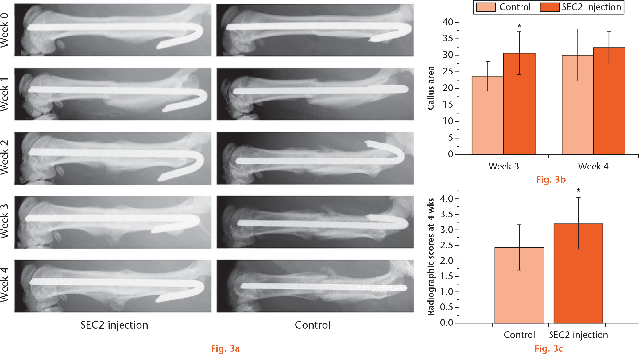  
            a) Radiographic analyses of fracture healing with Staphylococcal enterotoxin C2 (SEC2) treatment. Bone formation in fracture sites was detected by x-ray assays. b) Graph showing that larger callus areas were found in the SEC2-treated group. c) Graph showing that higher radiographic scores were observed in the SEC2-treated group. *p < 0.05 versus control.
          