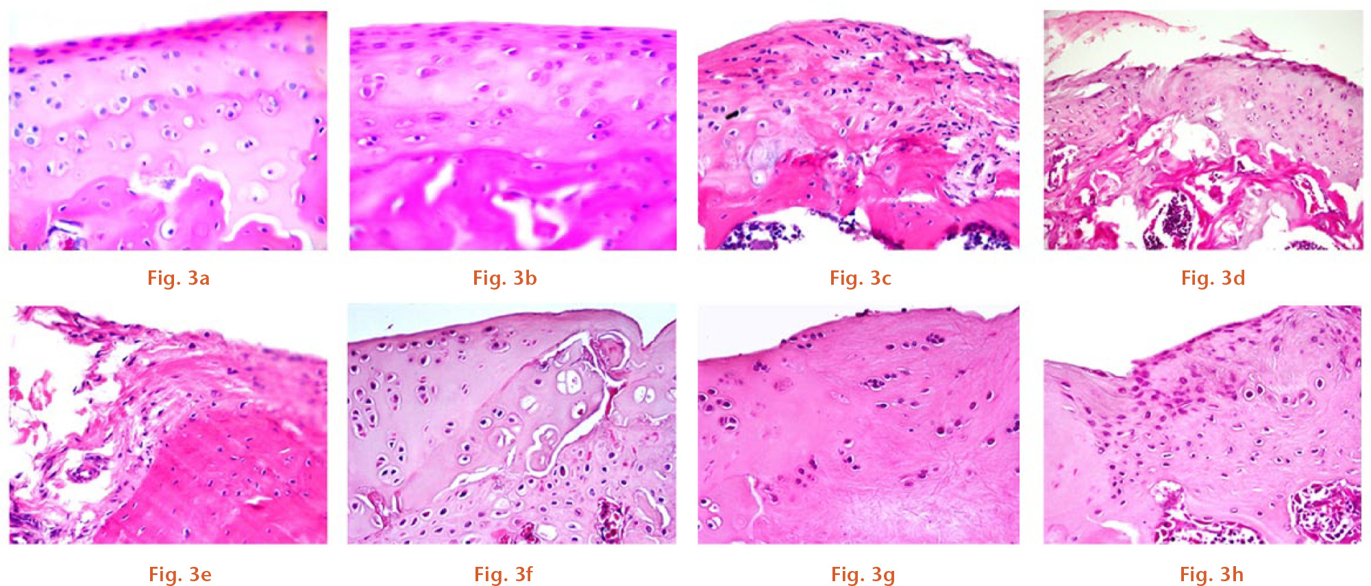  
            Histopathological evaluation of representative haematoxylin and eosin (H&E) staining sections of articular cartilage from the rat femoral condyle in the (a) naïve and (b) sham groups at 12 weeks post-surgery, and in the (c to e) anterior cruciate ligament transection (ACLT) and (f to h) osteochondral injury groups at four, eight and 12 weeks post-surgery, respectively (original magnification, x 100).
          