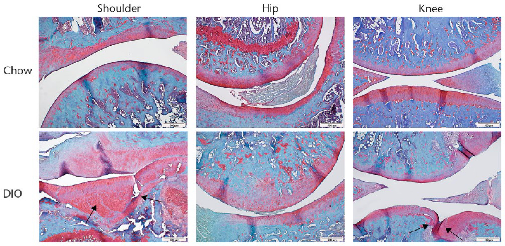 Fig. 2 
            Histology images taken at ×10, showing that DIO leads to increases in joint damage in shoulder and knee joints, but not hip joints. Scale bars indicate 500 μm. Black arrows indicate lesions.
          