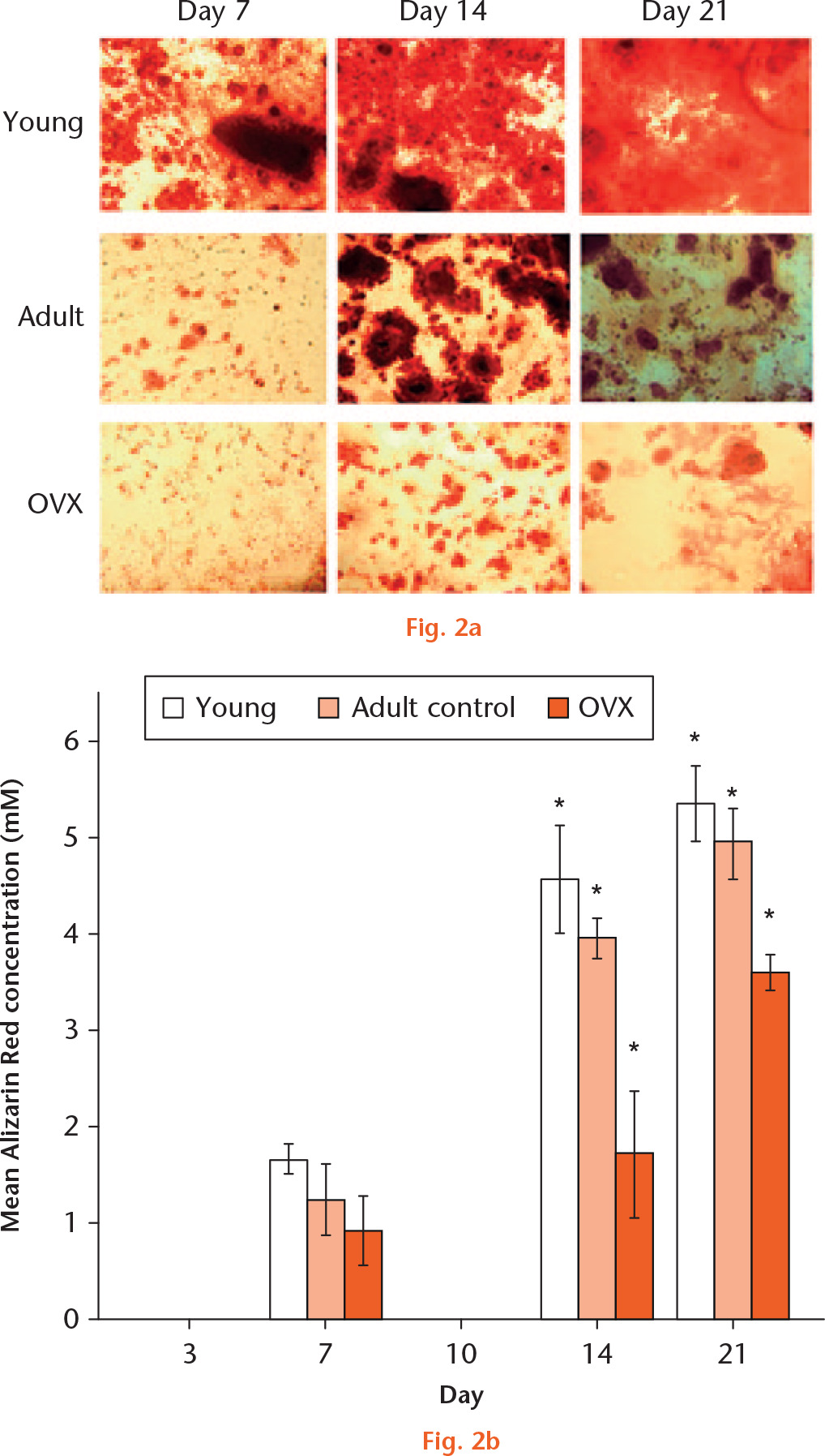  
            a) Alizarin staining to show osteogenic differentiation of young, adult, and ovariectomized (OVX) mesenchymal stem cells (MSCs) at day seven, 14, and 21. b) Graph showing the mean Alizarin Red production when MSCs from young, adult control, and OVX rats (n = 3) differentiated to osteoblasts at days seven, 14, and 21. *Significant difference of p < 0.05 using a two-tailed Student’s t-test.
          