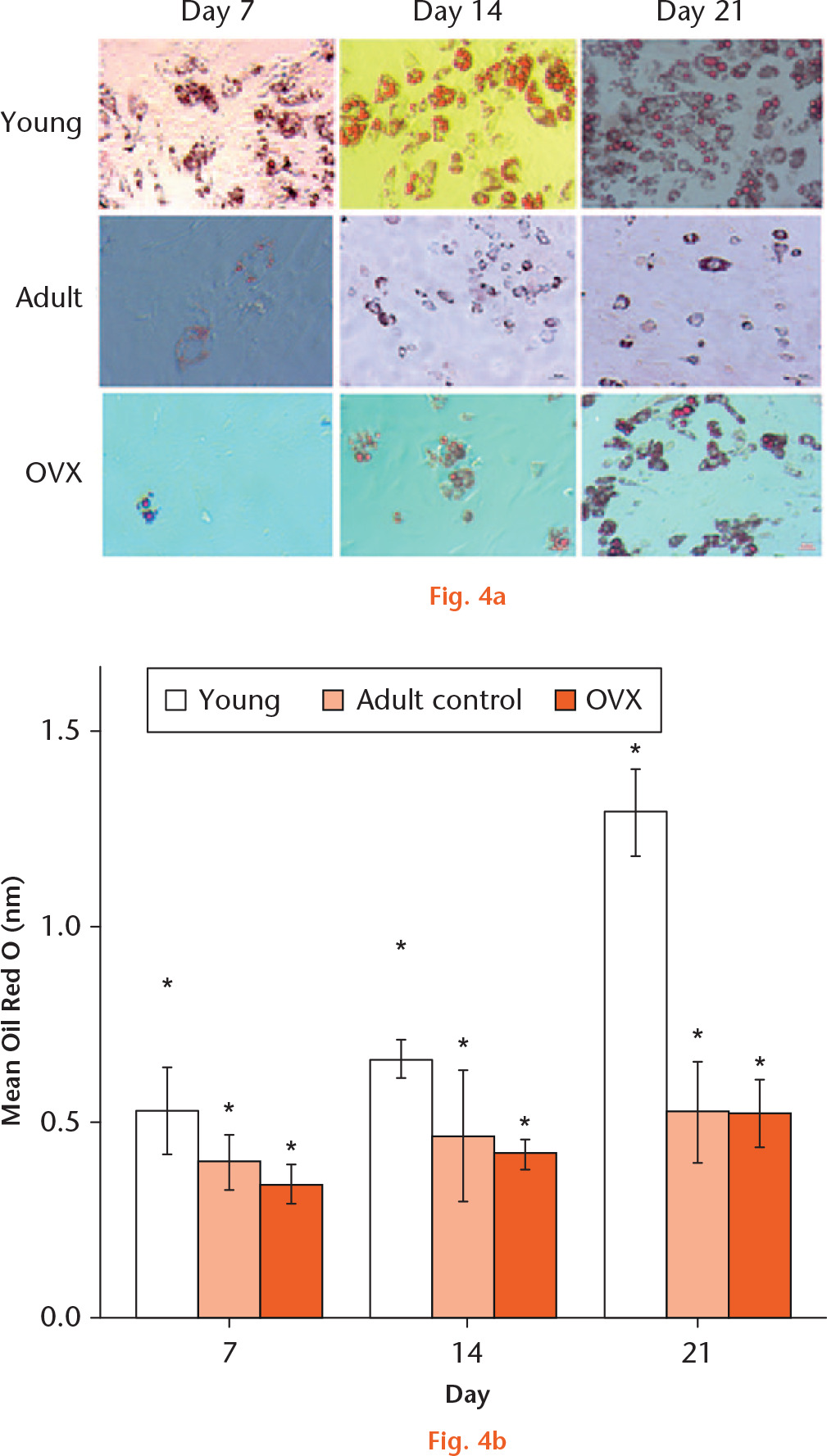  
            a) Oil Red O staining to show adipogenic differentiation of young, adult, and ovariectomized (OVX) mesenchymal stem cells (MSCs) at day seven, 14, and 21. b) Graph showing the mean Oil Red O production when MSCs from young, adult control, and OVX rats (n = 3) differentiated to adipocytes at days seven, 14, and 21. *Significant difference of p < 0.05 using a two-tailed Student’s t-test.
          
