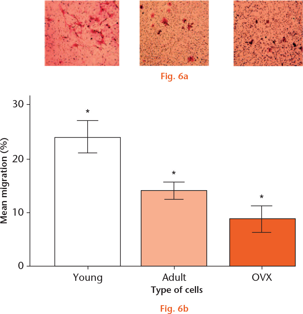  
            Images of a) young, b) adult control, and c) ovariectomized (OVX) mesenchymal stem cells (MSCs) migrated towards stromal cell-derived factor 1 (SDF-1) in a Boyden chamber and stained with crystal violet. d) Graph showing the mean percentage migration of uninfected MSCs from young, adult control, and OVX rats in a transwell chamber towards SDF-1. *Significant difference of p < 0.05 using a two-tailed Student’s t-test.
          