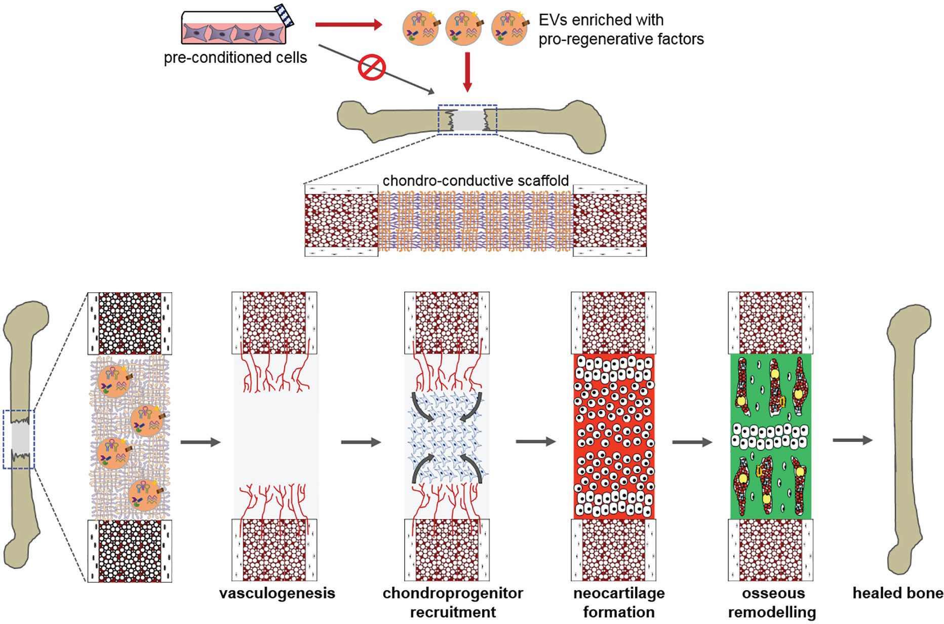 Fig. 4 
          Diagram showing therapeutic targets for endochondral repair. Bottlenecks to endochondral bone repair include progressive vascularization, chondroprogenitor recruitment, neocartilage formation, and osseous remodelling. It may be possible to deliver extracellular vesicles (EVs) harvested in vitro from promising parent cell cultures that stimulate endogenous cells to overcome one or more of these bottlenecks. An ideal scaffold for this approach would not only be chondro-conductive but would also control the release of therapeutic EVs, in order to match the migration timeframe of target repair cells (endothelial, chondroprogenitor) into the defect.
        