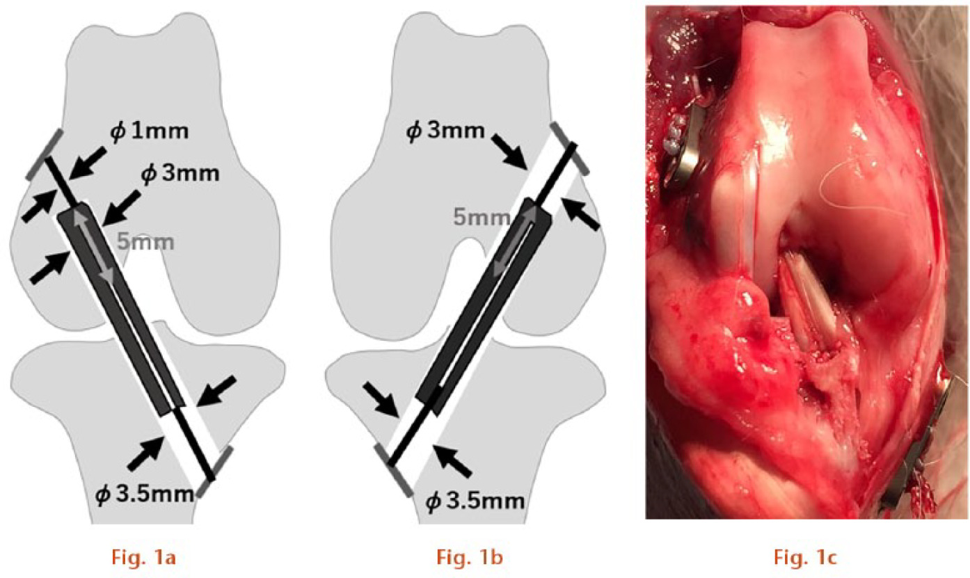  
          a) For the Socket group (group S), anterior cruciate ligament (ACL) surgeries were conducted in the right knee to mimic adjustable fixation devices; b) for the Tunnel group (group T), ACL surgeries were conducted in the left knee to mimic fixed fixation devices; c) after final fixation (Right knee).
        