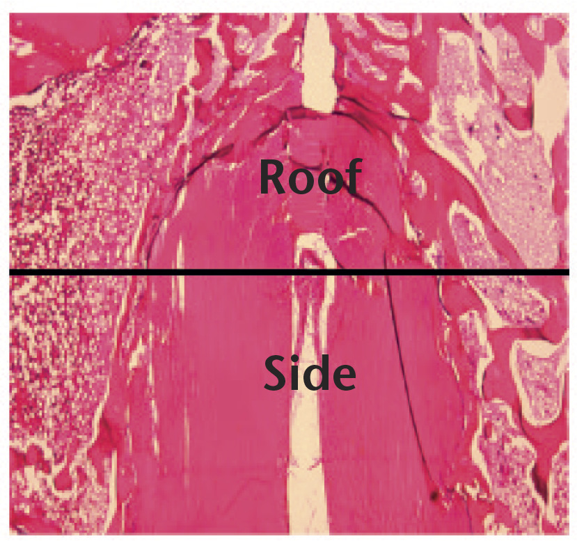 Fig. 2 
            The roof zone was defined as the area spanning a length of 1.5 mm from the end of the graft loop to the roof of the socket. The side zone was defined as the area 2 mm distal to the end of the roof zone on each side (scale bar, 1.0 mm).
          