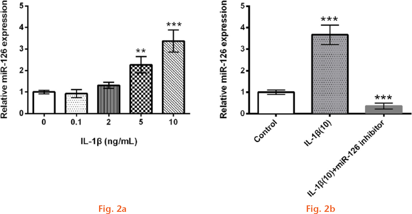 
            Graphs showing that miR-126 was upregulated in interleukin (IL)-1β-administrated CHON-001 cells: a) relative miR-126 expression measured by quantitative polymerase chain reaction (qPCR) in IL-1β administrated CHON-001 cells; b) relative miR-126 expression measured by qPCR after IL-1β administration and/or miR-126 inhibitor transfection (**p < 0.01; ***p < 0.001).
          